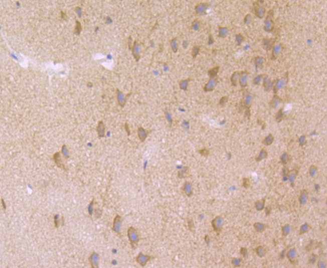 Anti-Nuclear Matrix Protein p84 Antibody (8Q603)
