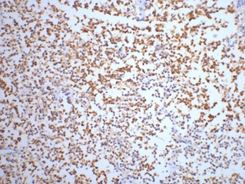 Anti-NSE/ENO2 Antibody (7Z725)