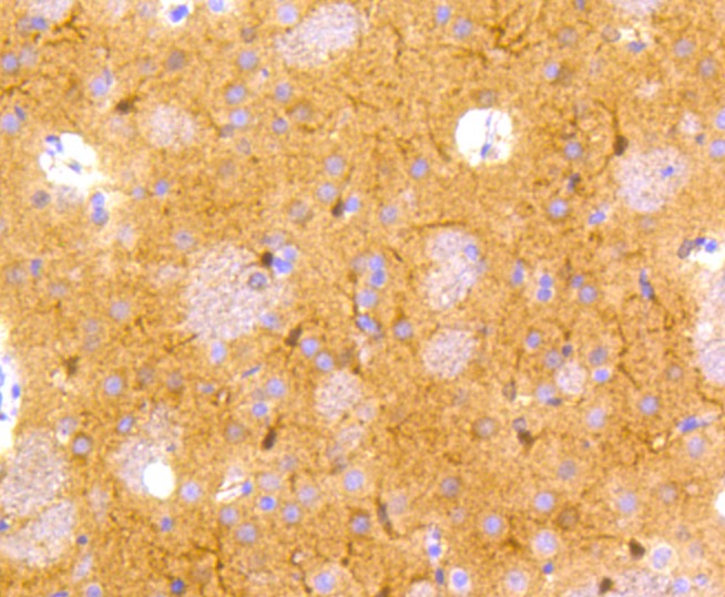 Anti-NSE/ENO2 Antibody (8L64)