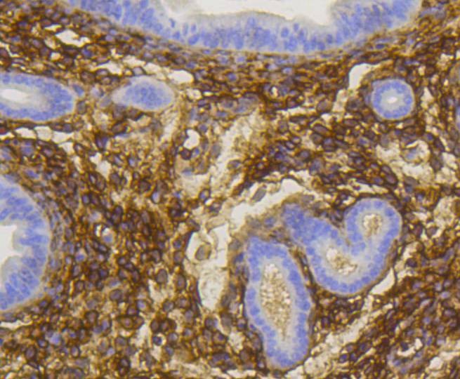 Anti-NGFR/p75NTR Antibody (2N149)