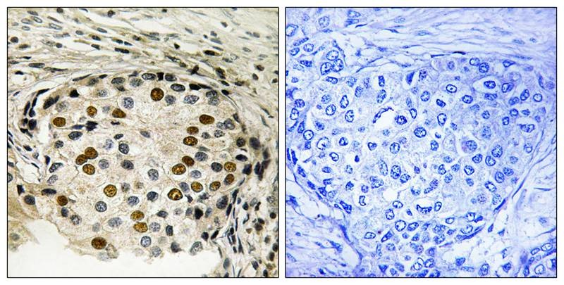 Anti-Phospho-OXSR1 (Thr185) Polyclonal Antibody