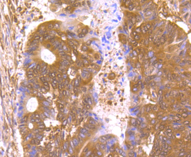Anti-Nuclear Matrix Protein p84 Antibody (8Q603)