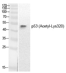 Anti-Acetyl-p53 (Lys320) Polyclonal Antibody