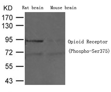 Anti-Phospho-OPRM1 (Ser375) Polyclonal Antibody