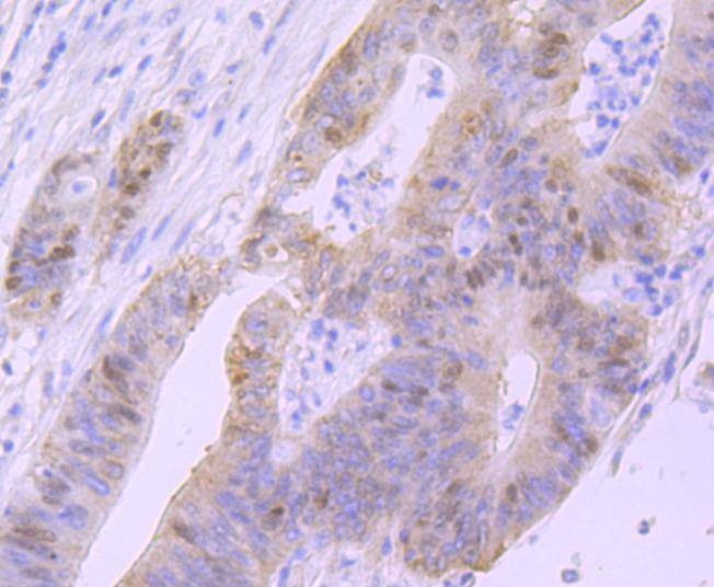 Anti-p53 Antibody (4S402)