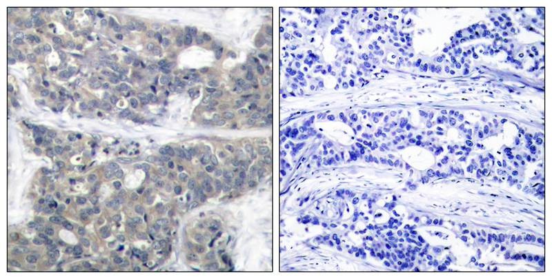 Anti-Phospho-S6K1/RPS6KB1 (Thr421) Polyclonal Antibody