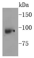 Anti-NBN Antibody (9Z721)