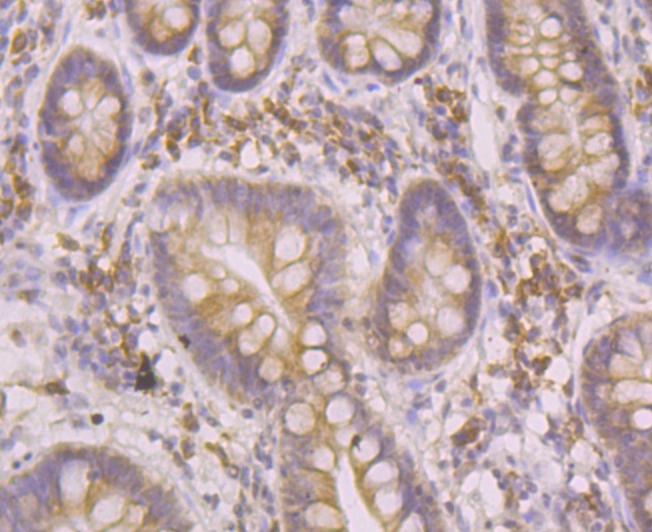 Anti-ORP150 Antibody (6Q346)