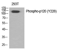 Anti-Phospho-p120 (Tyr228) Polyclonal Antibody