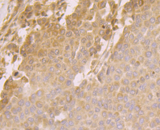 Anti-ORP150 Antibody (6Q346)