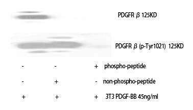 Anti-Phospho-PDGFRB (Tyr1021) Polyclonal Antibody