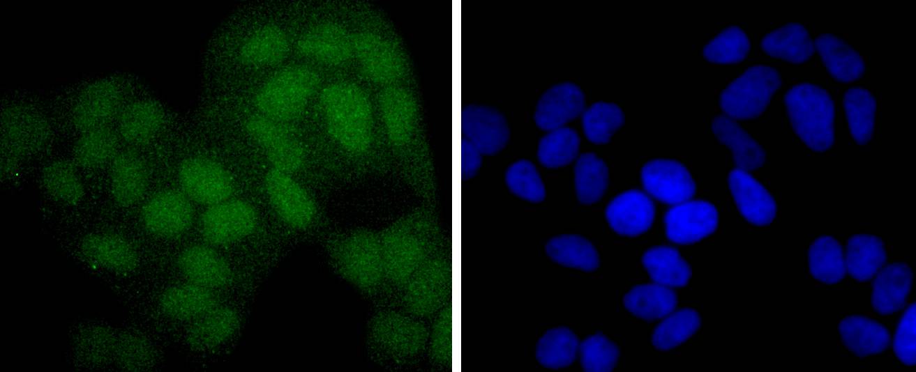 Anti-PAX5 Antibody (2B642)