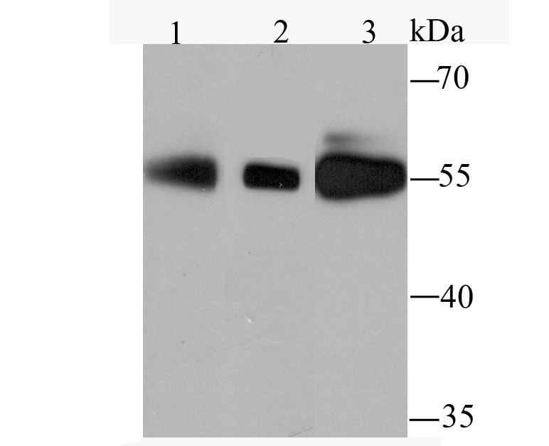 Anti-PFKFB3 Antibody (1B165)