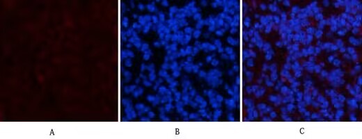 Anti-PDGF R alpha/PDGFRA Antibody (7T981)