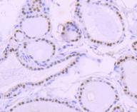Anti-PAX8 Antibody (4E844)
