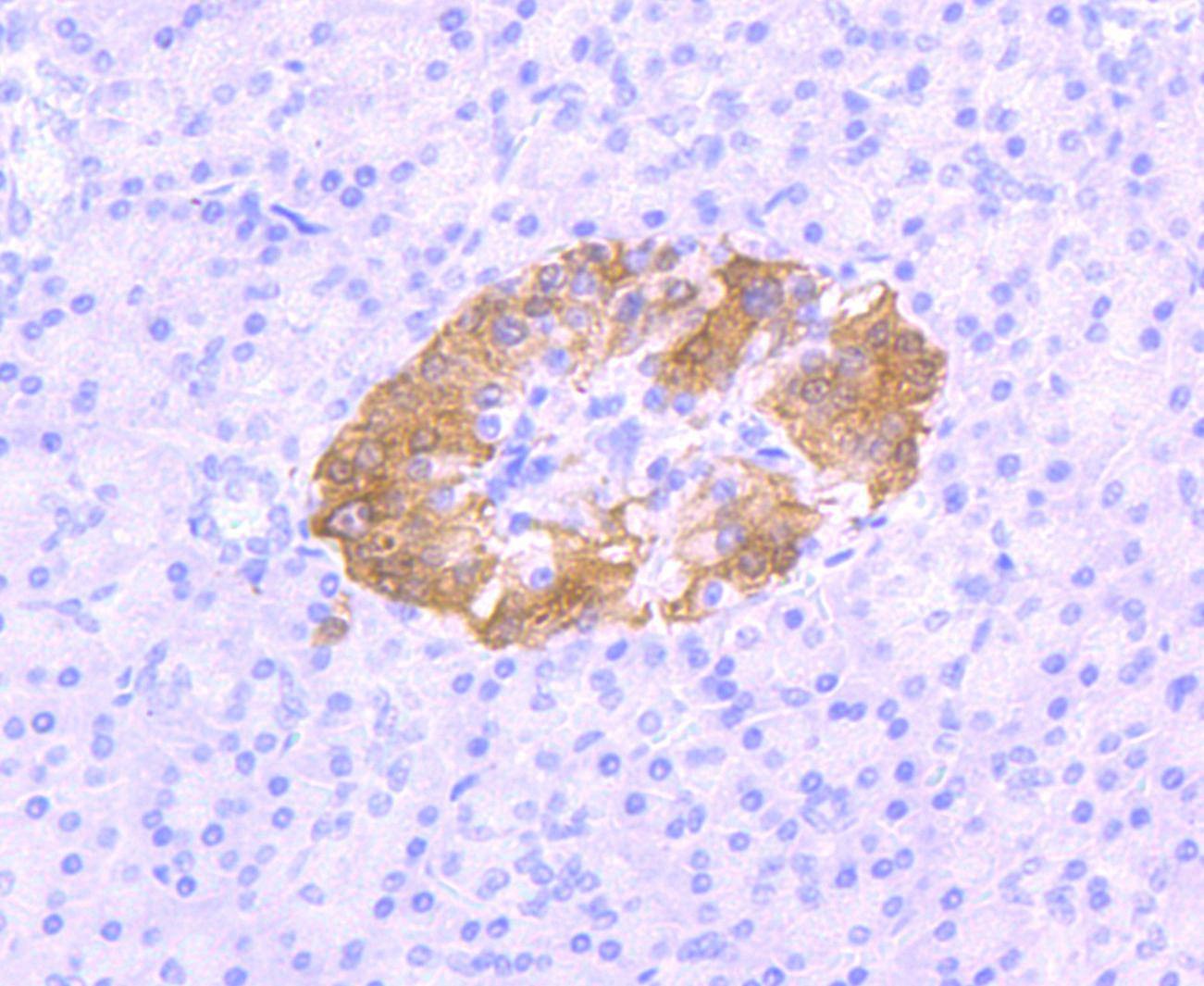 Anti-UCHL1 Antibody (8X527)