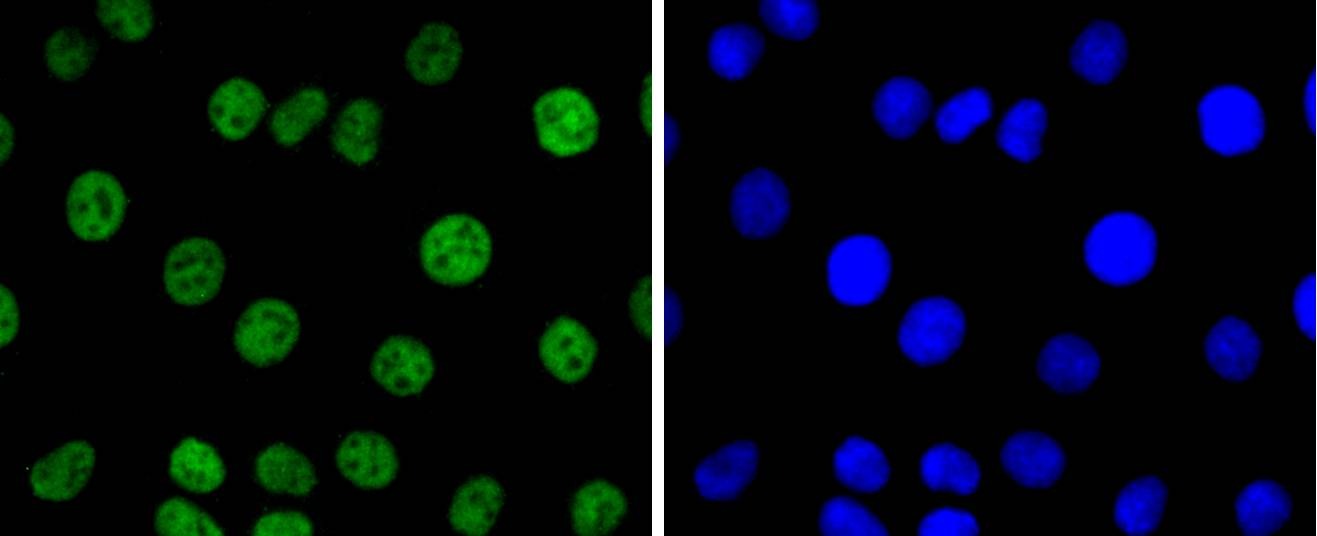 Anti-PAX8 Antibody (7Q264)
