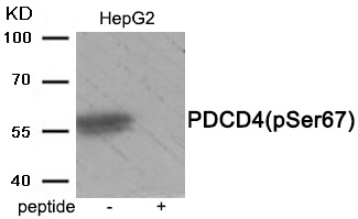 Anti-Phospho-PDCD4 (Ser67) Polyclonal Antibody