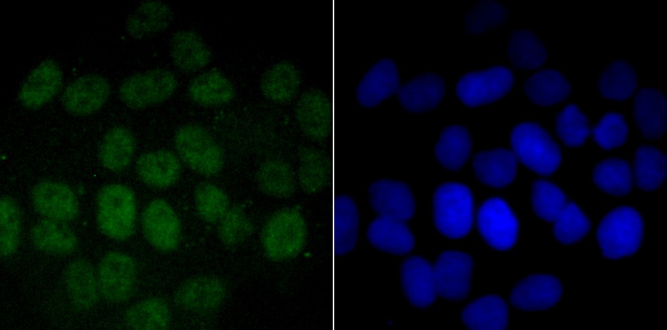 Anti-PFKFB3 Antibody (1B165)