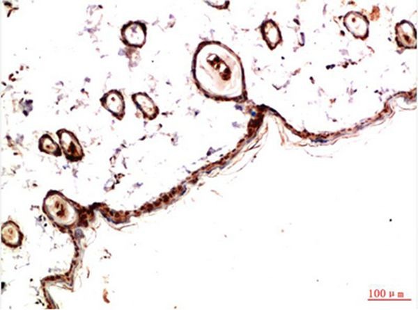 Anti-PDGF R alpha/PDGFRA Antibody (3H634)