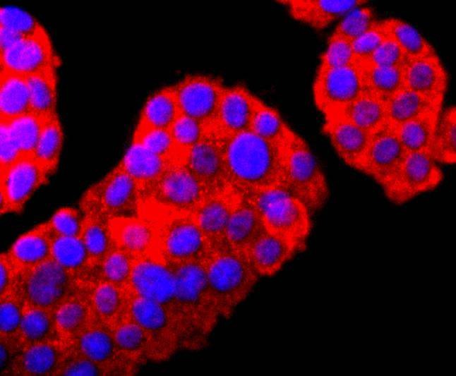 Anti-UCHL1 Antibody (8X527)