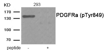 Anti-Phospho-PDGF R alpha/PDGFRA (Tyr849) Polyclonal Antibody