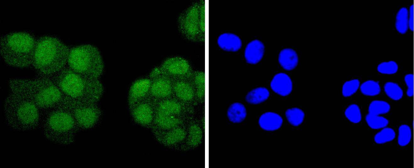 Anti-PAX5 Antibody (2B642)