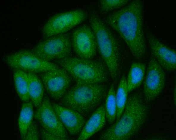 Anti-PAK2 Antibody (7G572)