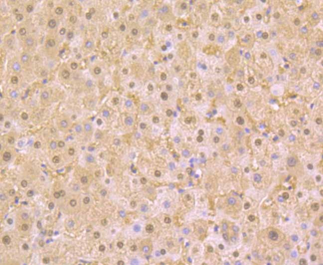 Anti-PAK2 Antibody (7G572)