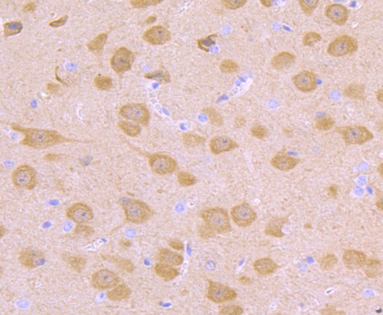Anti-UCHL1 Antibody (8X527)