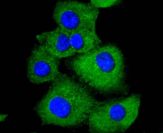 Anti-PXN Antibody (8Y831)