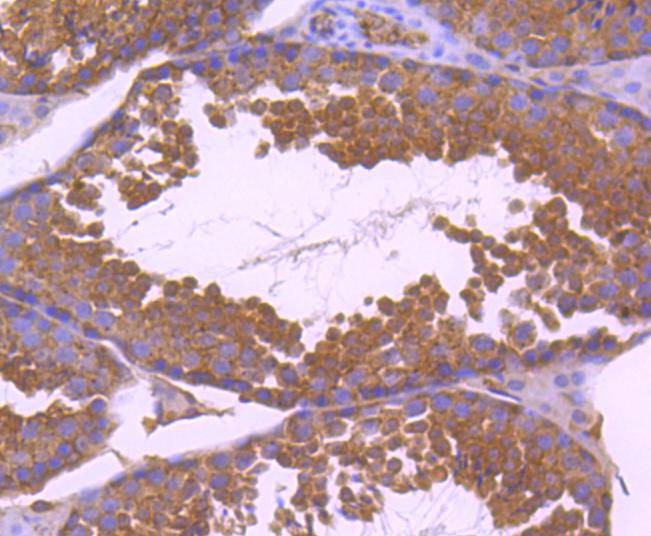 Anti-PXN Antibody (8Y831)