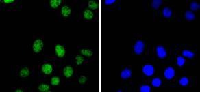 Anti-PAX8 Antibody (4E844)