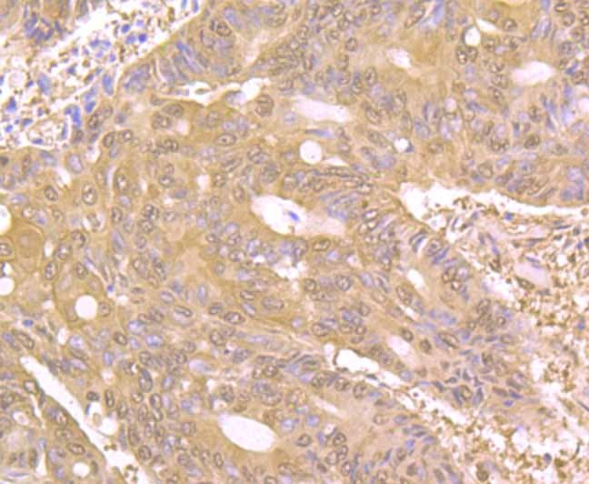Anti-PAK2 Antibody (7G572)