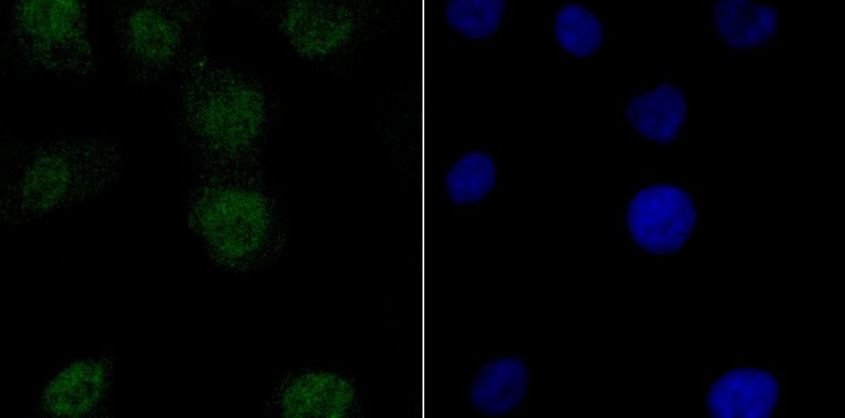 Anti-PFKFB3 Antibody (1B165)
