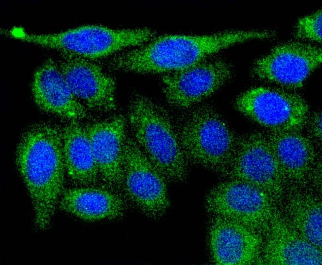 Anti-PGK1 Antibody (1H456)