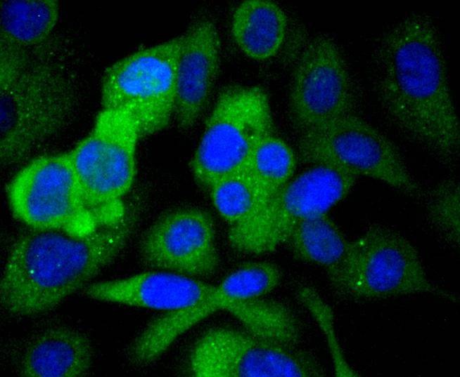 Anti-PXN Antibody (8Y831)