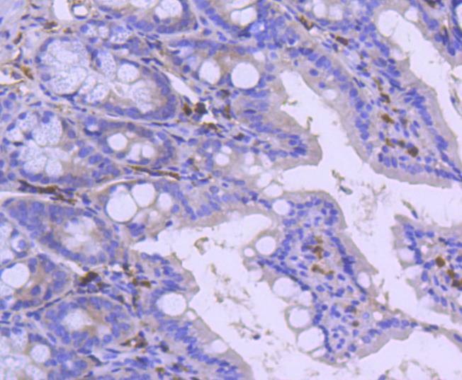 Anti-PARP1 Antibody (4Z18)