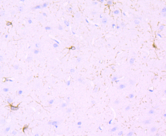 Anti-PDGF R alpha/PDGFRA Antibody (8J71)