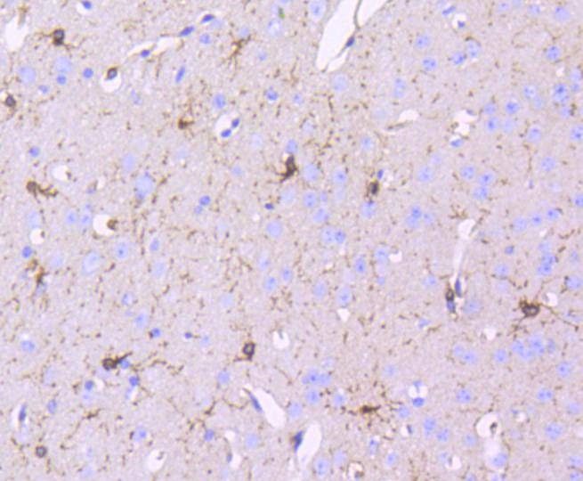 Anti-PDGFRB Antibody (6N196)