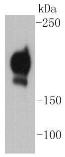 Anti-PDGFRB Antibody (6N196)