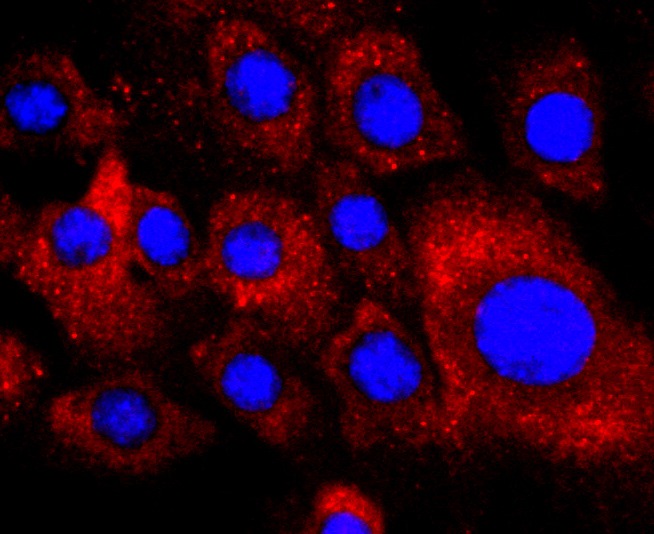Anti-PDGF R alpha/PDGFRA Antibody (8J71)