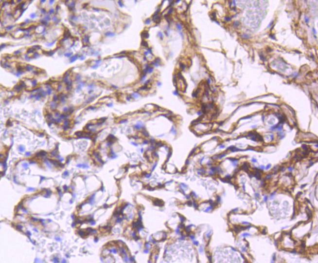 Anti-PDGFRB Antibody (6N196)