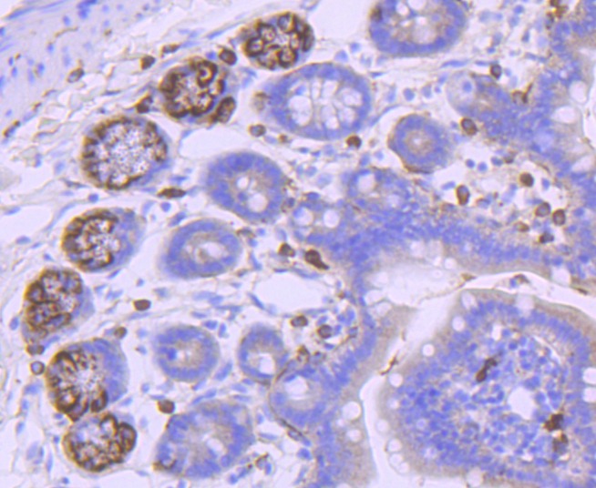 Anti-PDGF R alpha/PDGFRA Antibody (8J71)