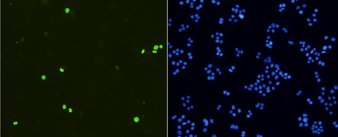 Anti-Phospho-HIST1H3A (Ser10) Antibody (5F765)