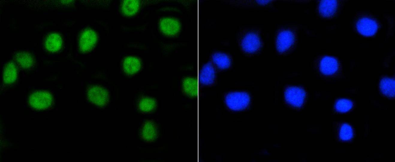 Anti-Phospho-RB1 (Ser807) Antibody (7O884)