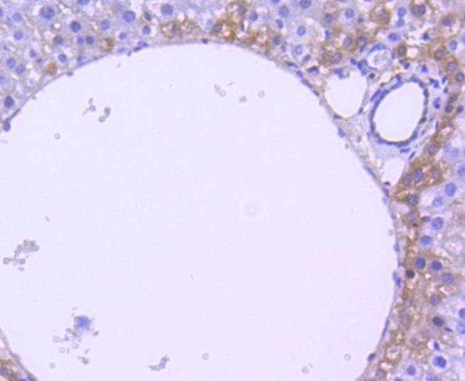 Anti-Phospho-RPS6KA1 (Thr359, Ser363) Antibody (9N204)