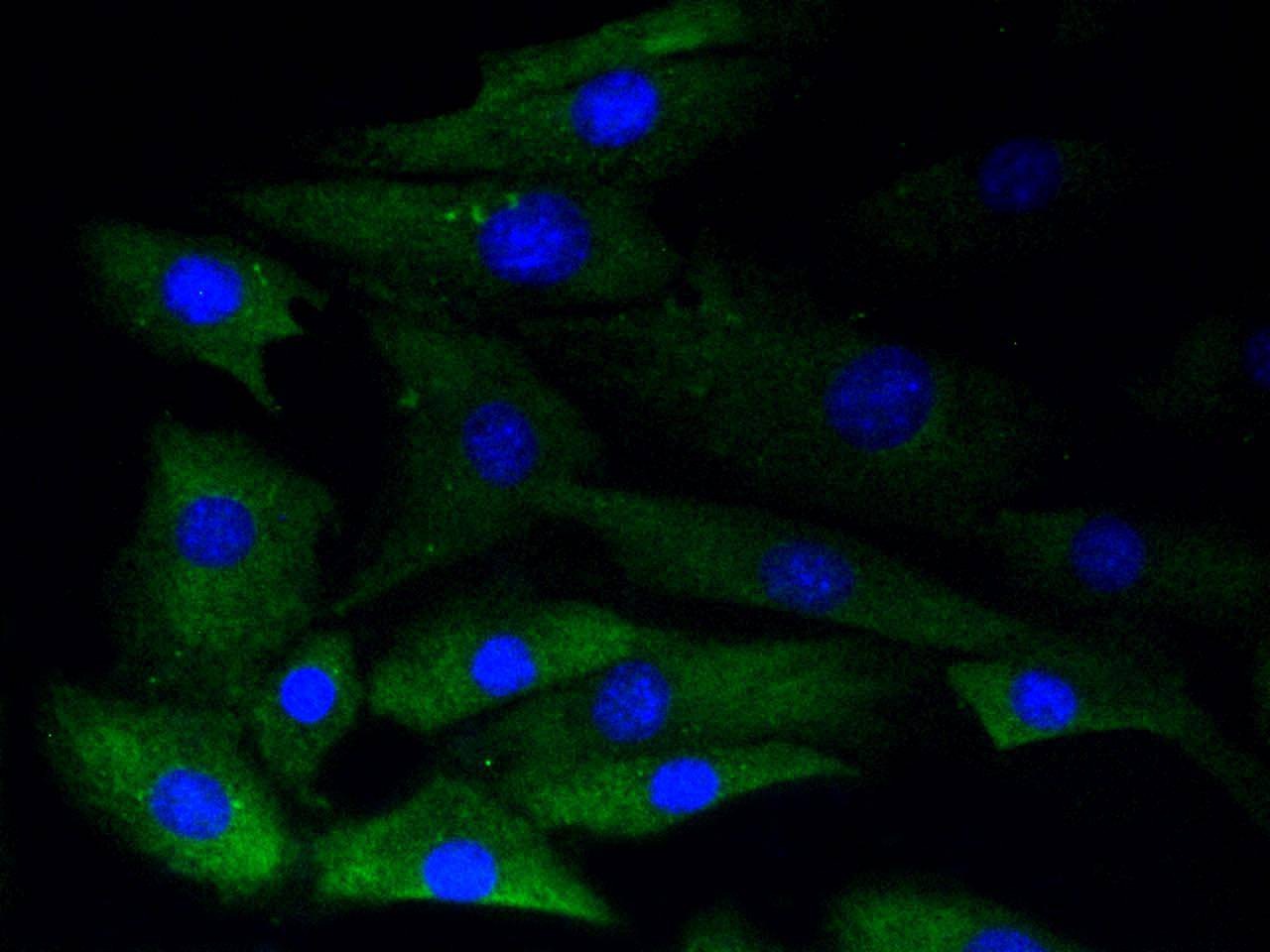 Anti-Phospho-GYS1 (Ser641) Antibody (6Y642)