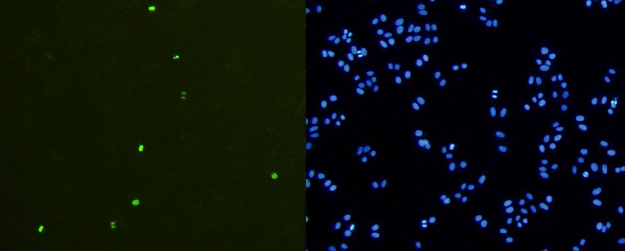 Anti-Phospho-HIST1H3A (Ser10) Antibody (5F765)