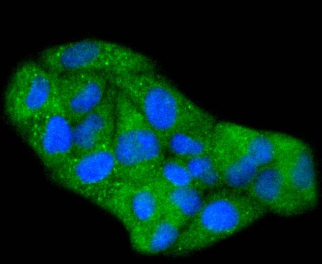 Anti-Phospho-Hsp27/HSPB (Ser78) Antibody (3C571)